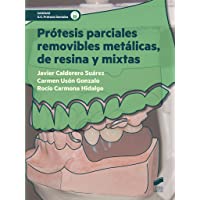 Prótesis parciales removibles metálicas- de resina y mixtas: 45 (Sanidad)